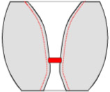 Balloffet-Repolissage_Usure-normal